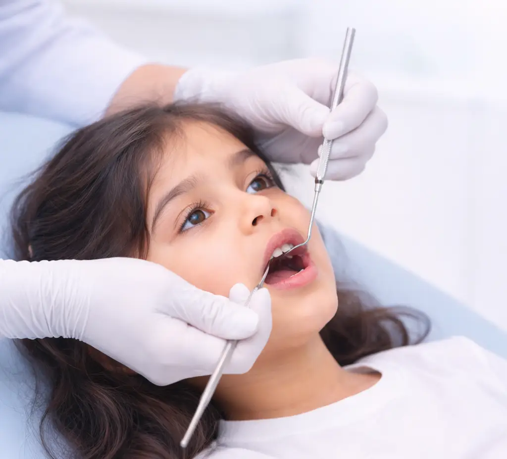 Tooth Coloured Fillings